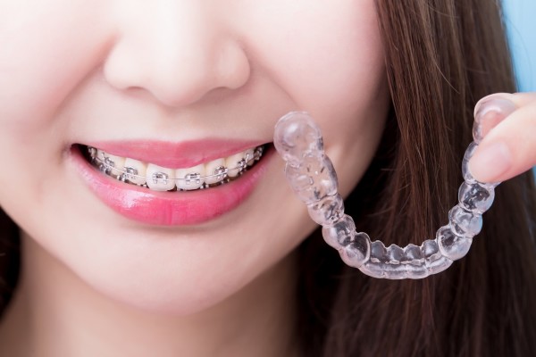 LES SEPT FAMILLES D’APPAREILLAGES ORTHODONTIQUES